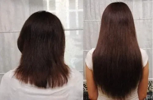 photo: Hairstim - мнения, коментари, отзиви, форум, резултати